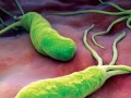 A prosztatarákhoz köthető baktériumokat azonosítottak