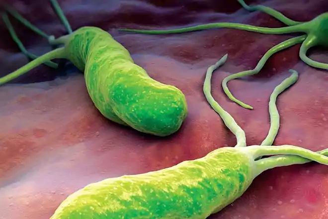 Helicobacter pylori baktérium