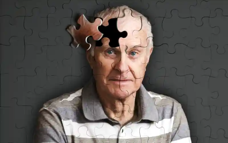 Az Alzheimer-kór ellen is bevetik a mesterséges intelligenciát